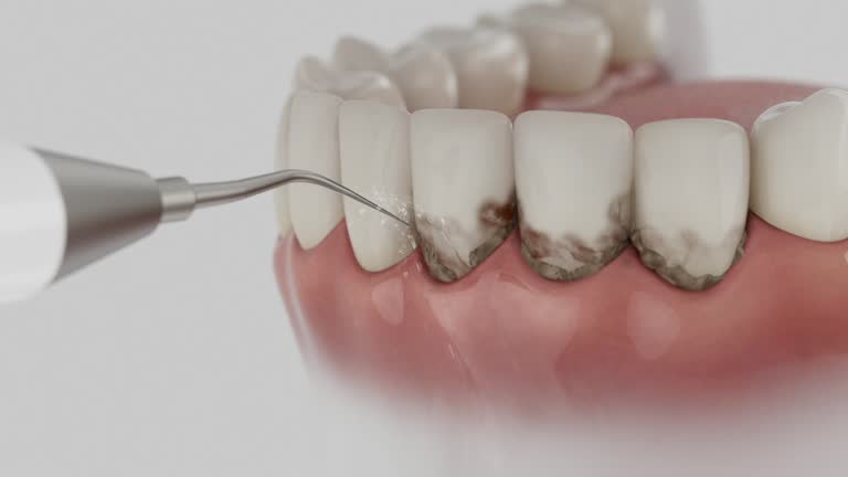 Trusted Teeth Cleaning And Checkup service in Mitchell, NE - Dentist Open Now